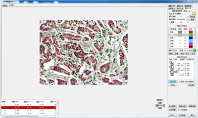  DB-3000顯微圖像分析軟件/生物圖像分析軟件/細胞統(tǒng)計軟件